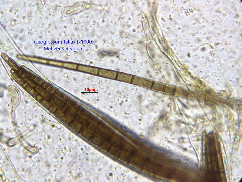 Geoglossum fallax spores micrograph