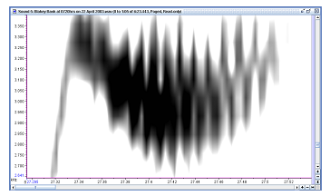 sonogram