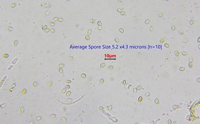 Spores of Alder bracket Xanthoporia radiata